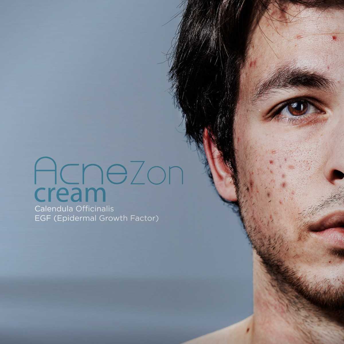 AcneZon Cream